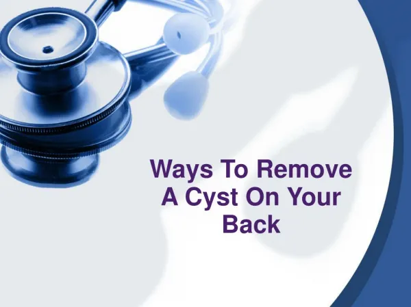 Ways To Remove A Cyst On Your Back
