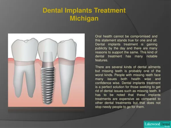 Dental implant specialist Michigan