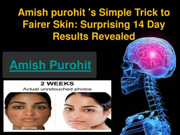 Amish purohit 's Simple Trick to Fairer Skin: Surprising 14 Day Results Revealed