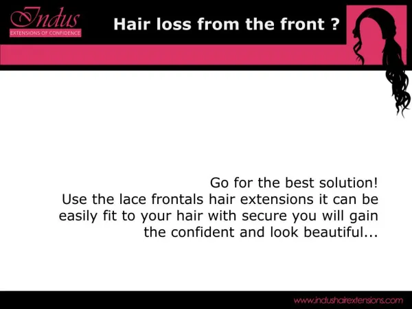 front side hair loss sort out