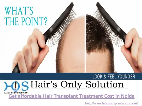 Natural Hair Transplant Clinic Noida Call HOS