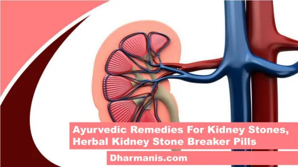 Ayurvedic Remedies For Kidney Stones, Herbal Kidney Stone Breaker Pills