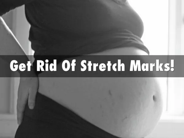 Stretch Marks - How to Get Rid Of Stretch Marks