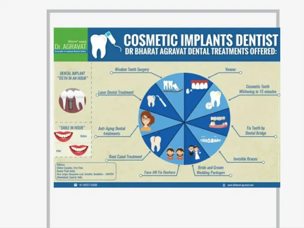 Cosmetic Implants Dentist Offered Low Cost Affordable Dental Treatments