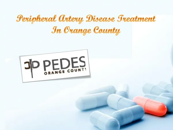Peripheral Artery Disease Treatment in Orange County