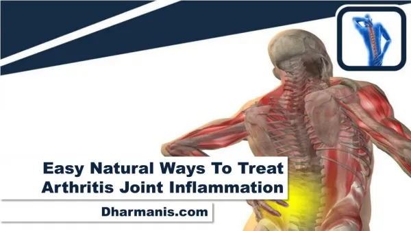 Easy Natural Ways To Treat Arthritis Joint Inflammation