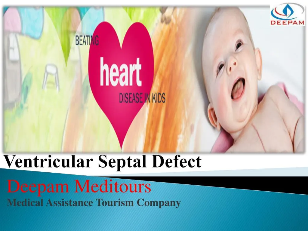 ventricular septal defect