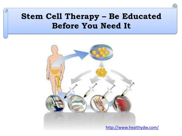 Stem Cell Therapy – Be Educated Before You Need It