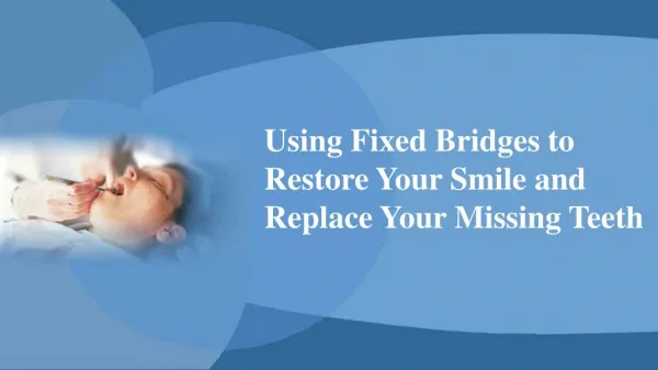 Using Fixed Bridges To Restore Your Smile And Replace Your Missing Teeth