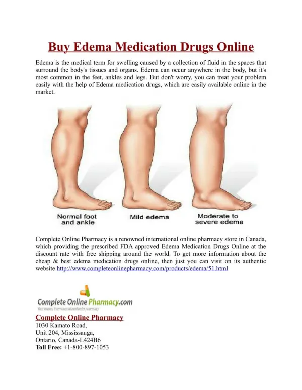 Buy Edema Medication Drugs Online