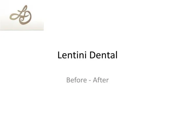 Before - After Dental treatment by Lentini dental Werribee