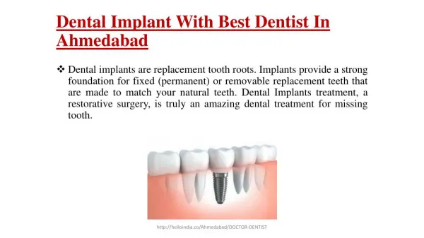 Dental implant with best dentist in ahmedabad