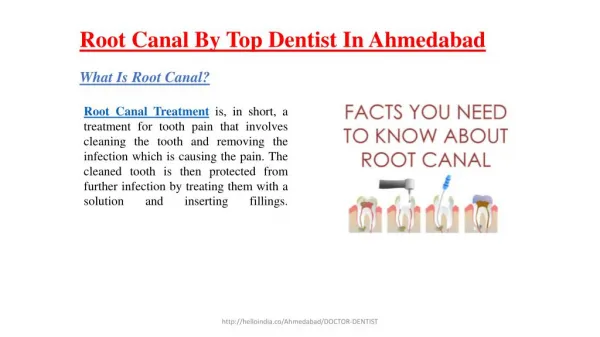 Root canal by top dentist in ahmedabad