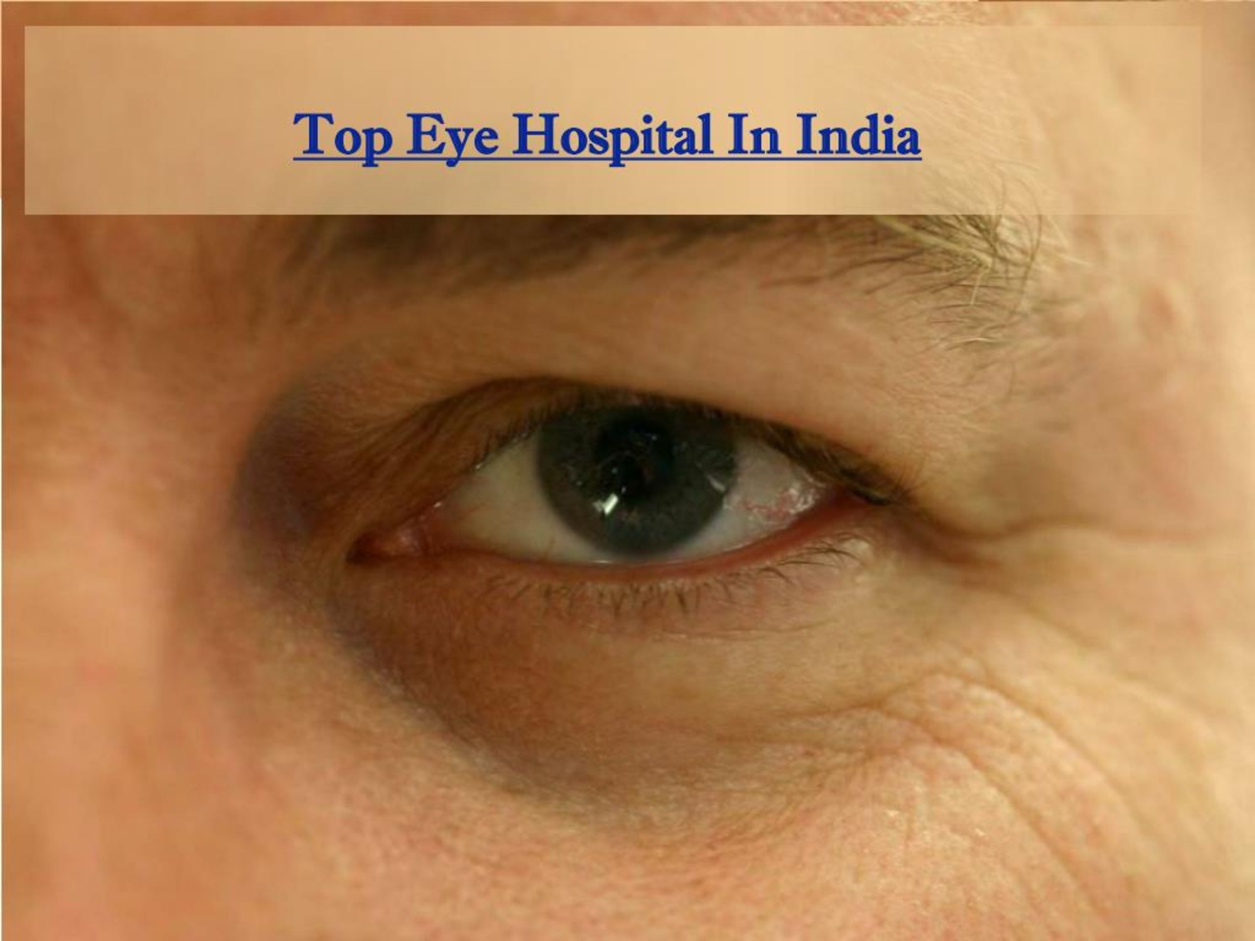 PPT - Top eye hospital in India PowerPoint Presentation, free download ...