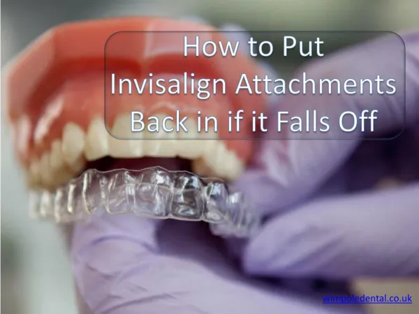 How To put Invisalign attachments back in if it Falls Off