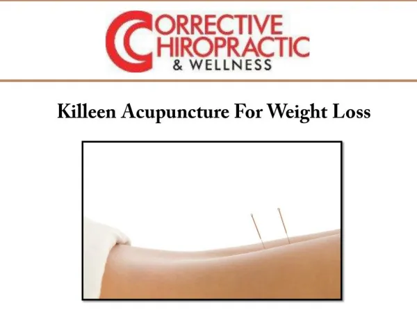 Killeen Acupuncture For Weight Loss
