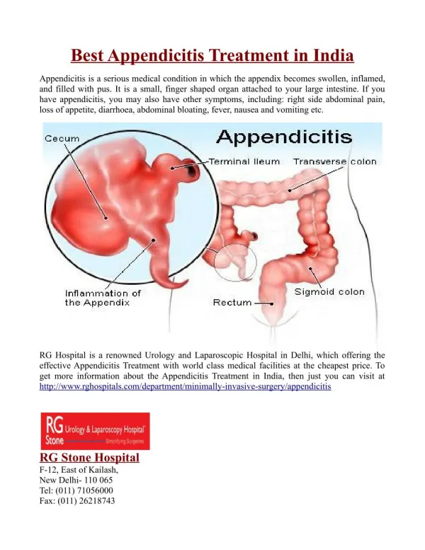 Best Appendicitis Treatment in India