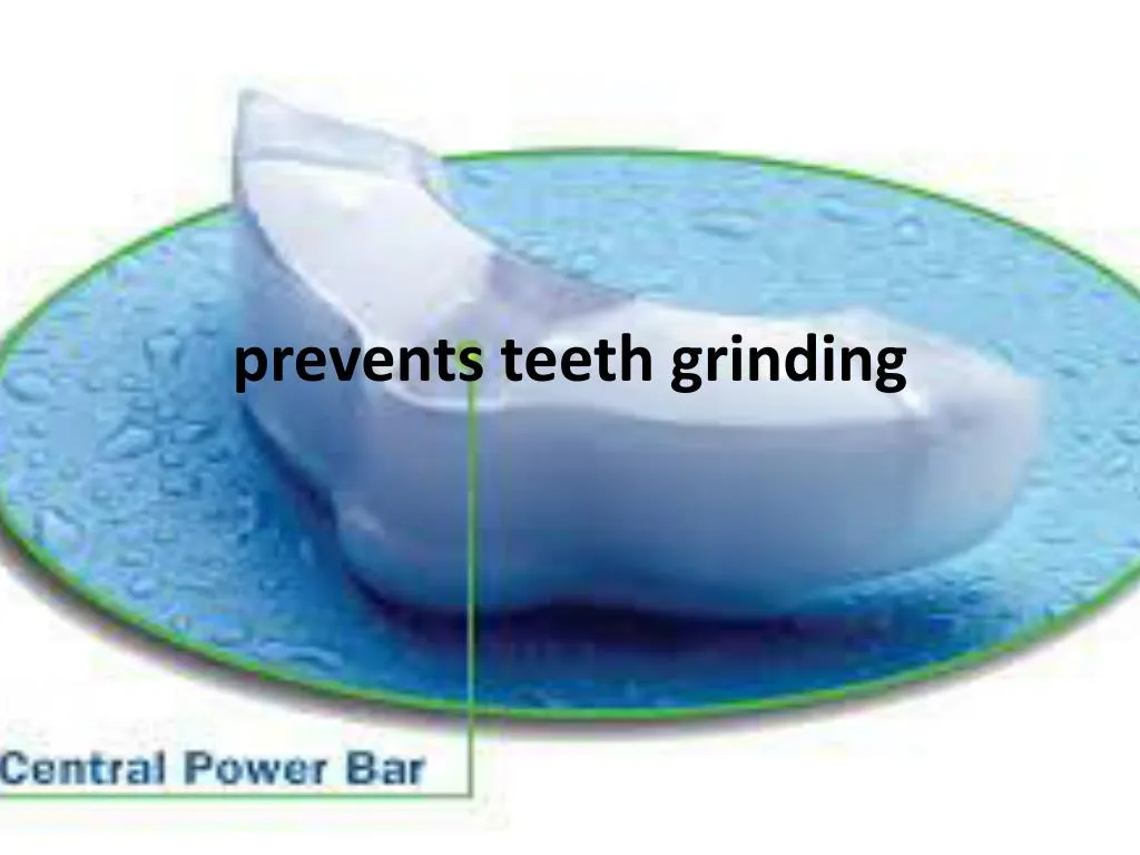 prevents teeth grinding