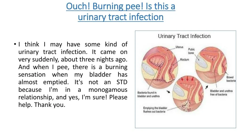 ouch burning pee is this a urinary tract infection