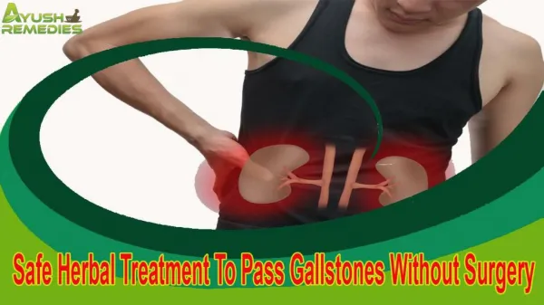 Safe Herbal Treatment To Pass Gallstones Without Surgery