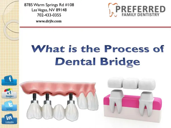 What is the Process of Dental Bridge - Preferred Family Dentistry