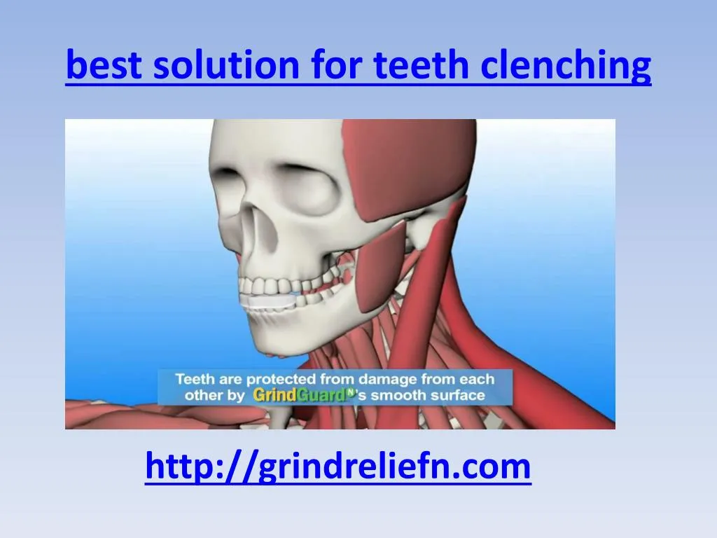 best solution for teeth clenching
