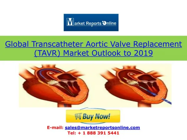 Global TAVR (Transcatheter Aortic Valve Replacement) Market 2019: Growth Drivers, Forecasts and Trends Featuring Edwards