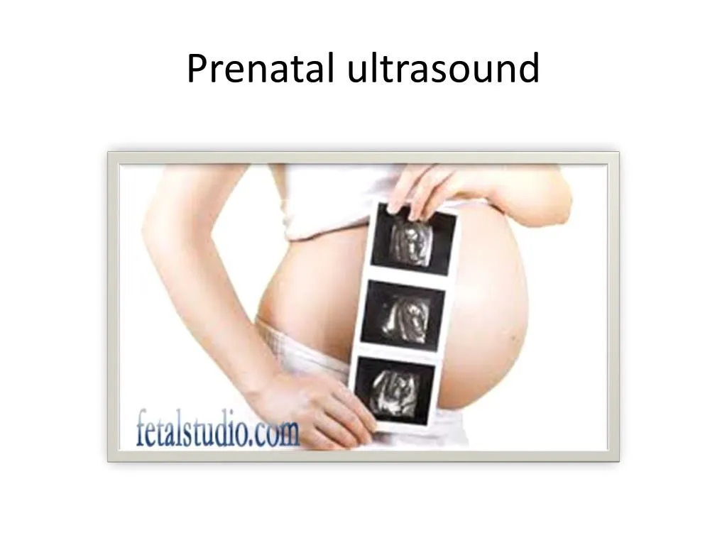 prenatal ultrasound