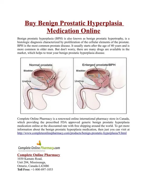 Buy Benign Prostatic Hyperplasia Medication Online
