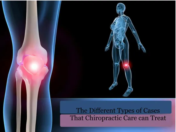 The Different Types of Cases That Chiropractic Care can Treat