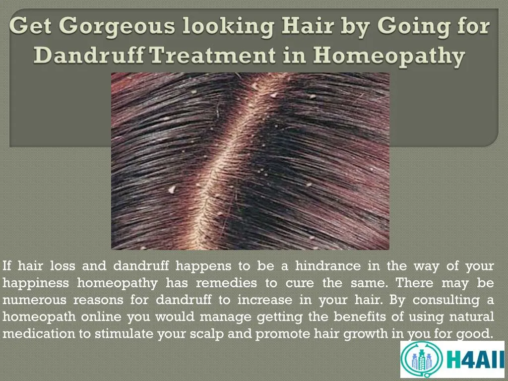 get gorgeous looking hair by going for dandruff treatment in homeopathy