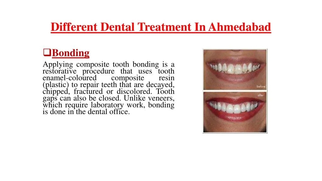 different dental treatment in ahmedabad