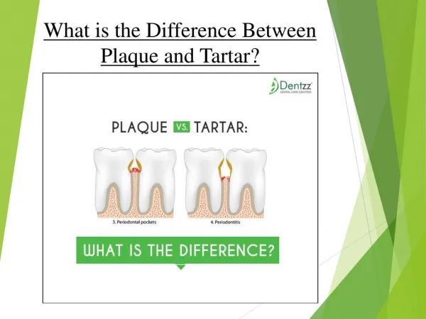 What is the Difference Between Plaque and Tartar