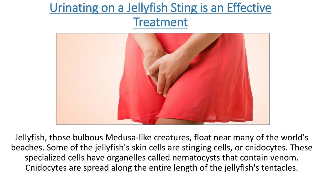 urinating on a jellyfish sting is an effective treatment