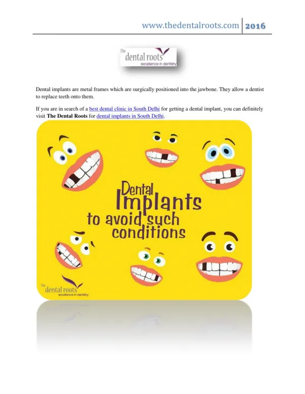 Best Dental Implants Clinic in South Delhi