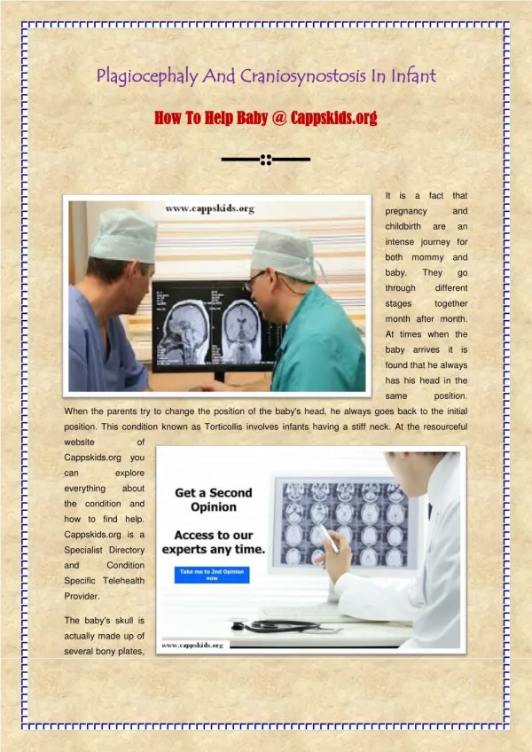 Plagiocephaly And Craniosynostosis