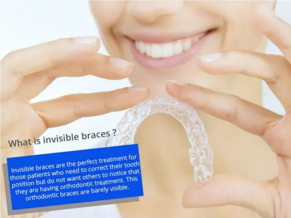 Benifits of Invisible Braces