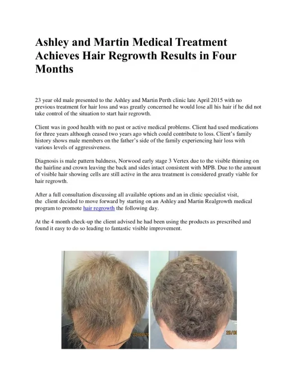 Ashley and Martin Medical Treatment Achieves Hair Regrowth Results in Four Months