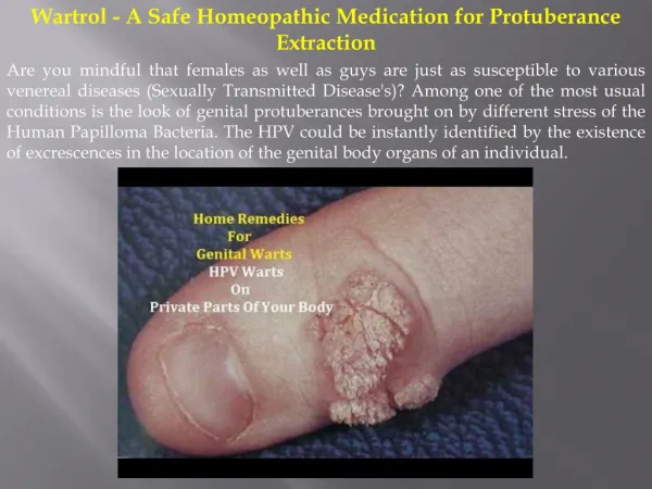 Wartrol A Safe Homeopathic Medication for Protuberance Extraction