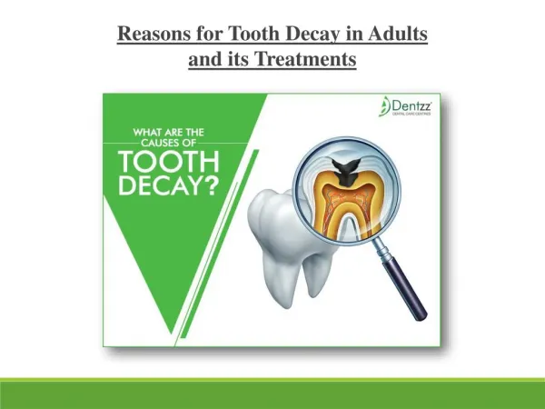 Reasons for tooth decay in adults and its treatments