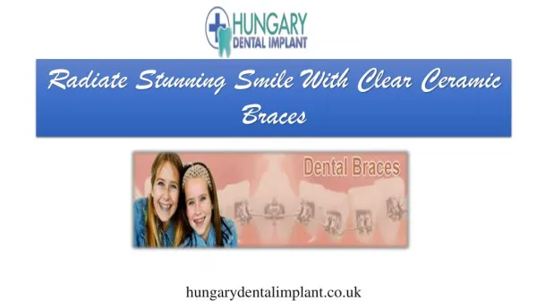 Beautiful Smile With Clear Ceramic Braces - Hungary Dental Implant London