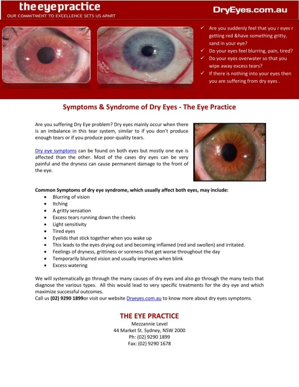 Symptoms & Syndrome of Dry Eyes - The Eye Practice