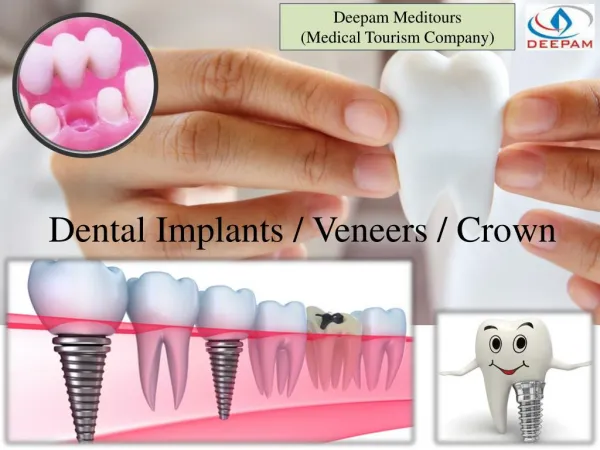 Dental - Implants Veneers & Crown