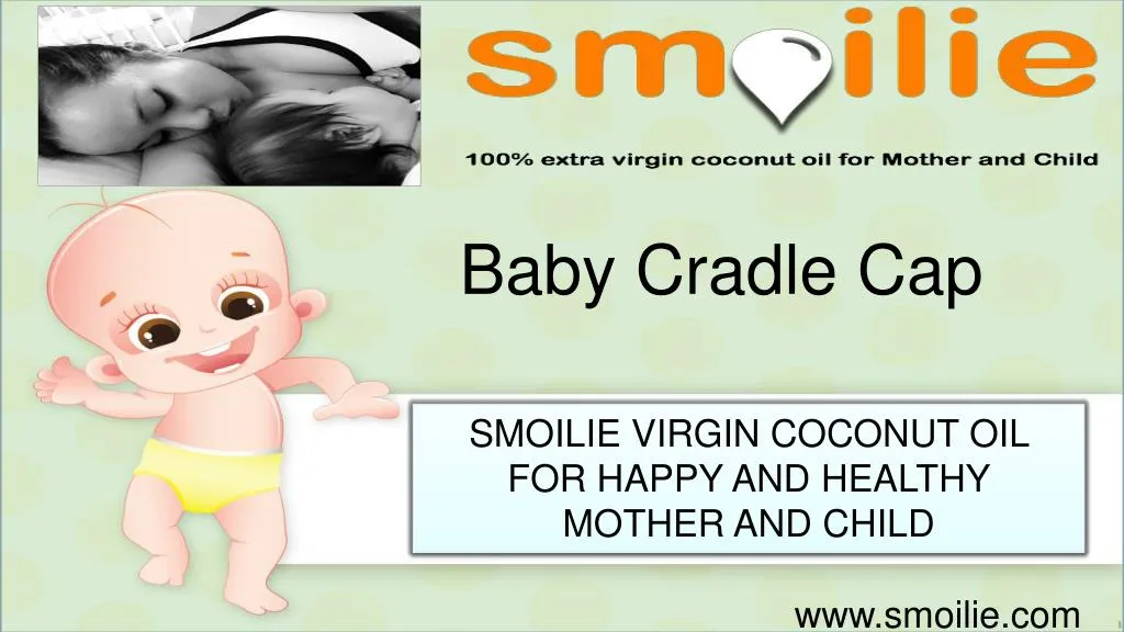 baby cradle cap