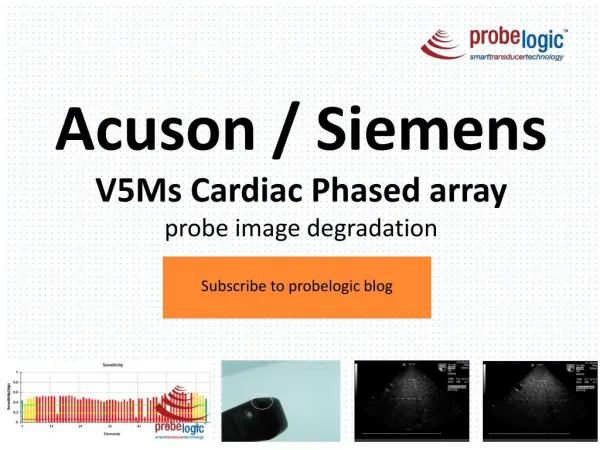 Acuson/Siemens V5Ms Cardiac Phased array probe image degradation