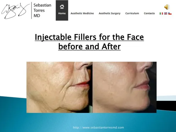 Injectable Fillers for The Face Before and After