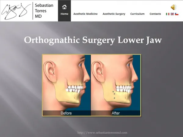 Orthognathic Surgery Lower Jaw