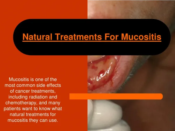 Natural Mucositis Cures