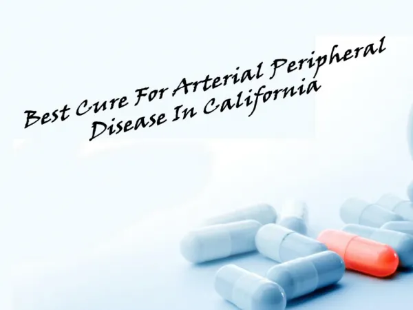 Best Cure For Arterial Peripheral Disease In California