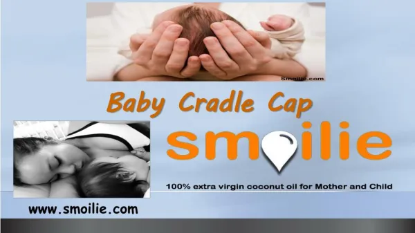 Baby Cradle Cap